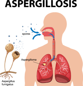 Aflatoxin Control In Milk -दुधातील Aflatoxin बुरशीचे नियंत्रण असे करा!